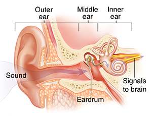 All About Ear Infections: Causes, Symptoms, and Treatments