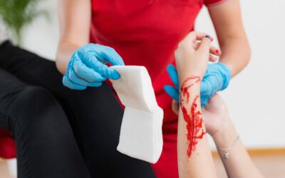 First Aid for Lacerations (Cuts): A Treatment Guide