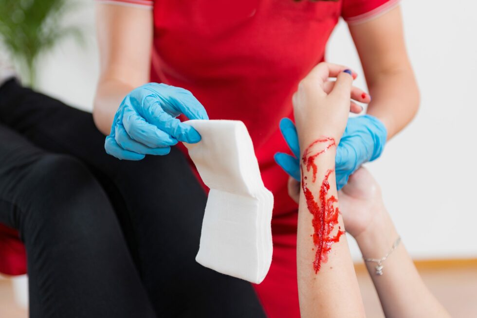 First Aid for Lacerations (Cuts) A Treatment Guide CityHealth