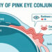 pink eye urgent care at CityHealth Oakland - conjunctivitis evaluation and prescription drops