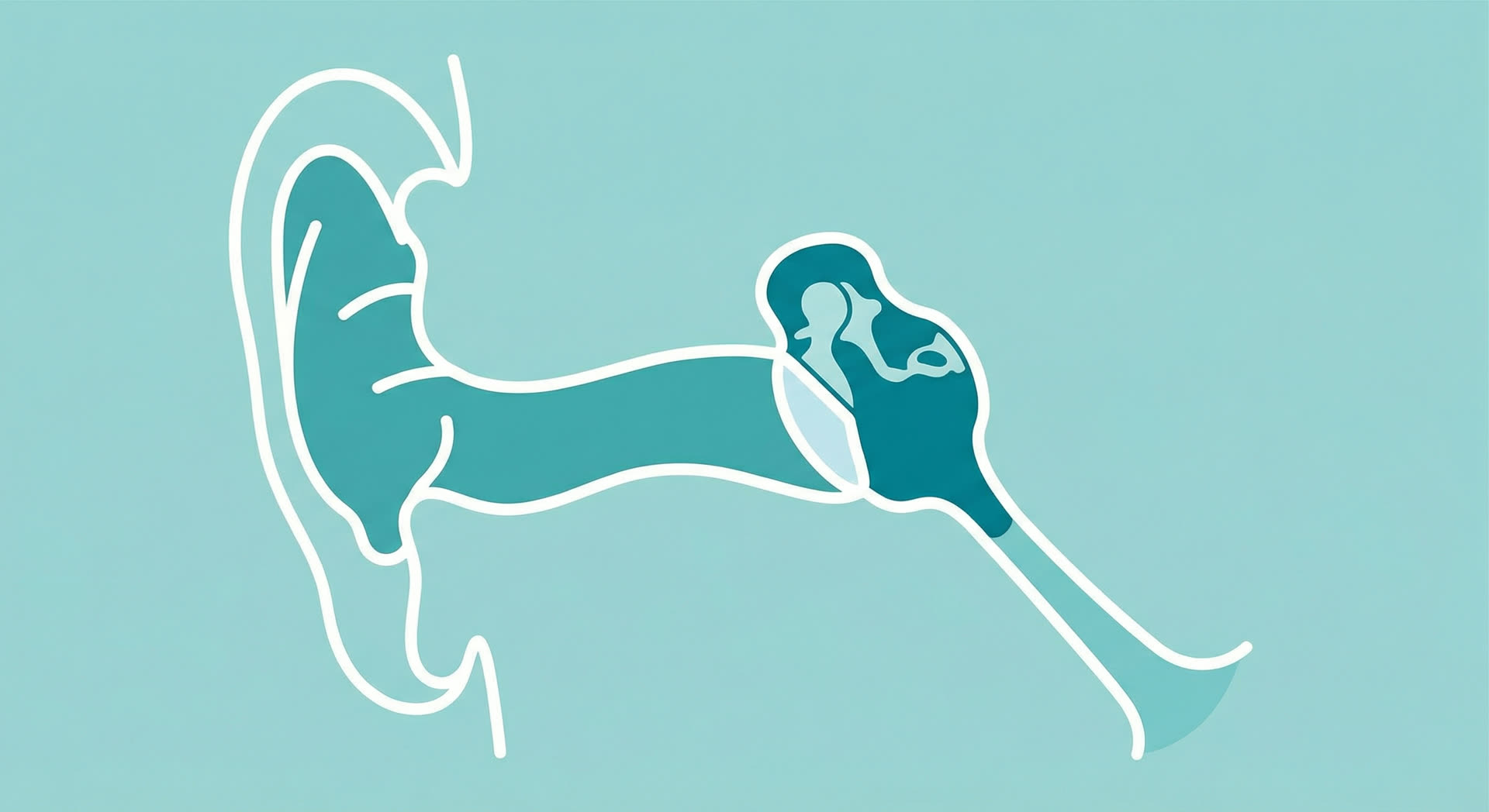 Medical illustration of ear anatomy showing ear infection in the middle ear