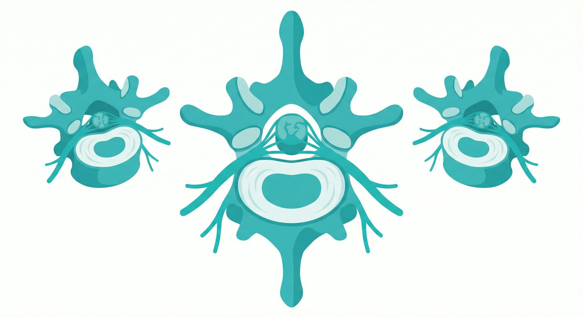 Medical illustration of spine anatomy showing lower back pain and lumbar vertebrae