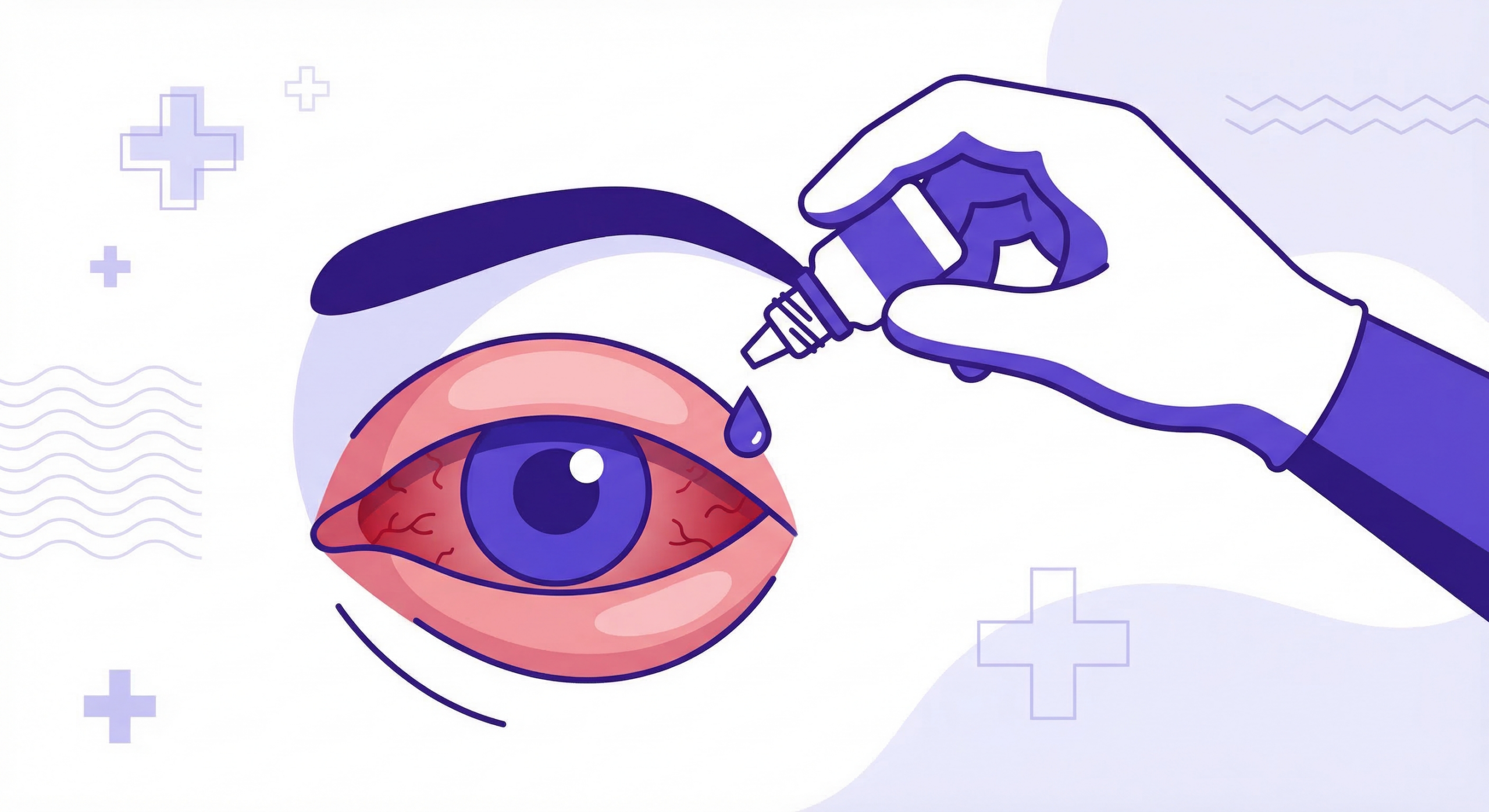 Pink Eye: Does Urgent Care Treat Conjunctivitis?