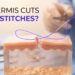 do dermis cuts need stitches — CityHealth