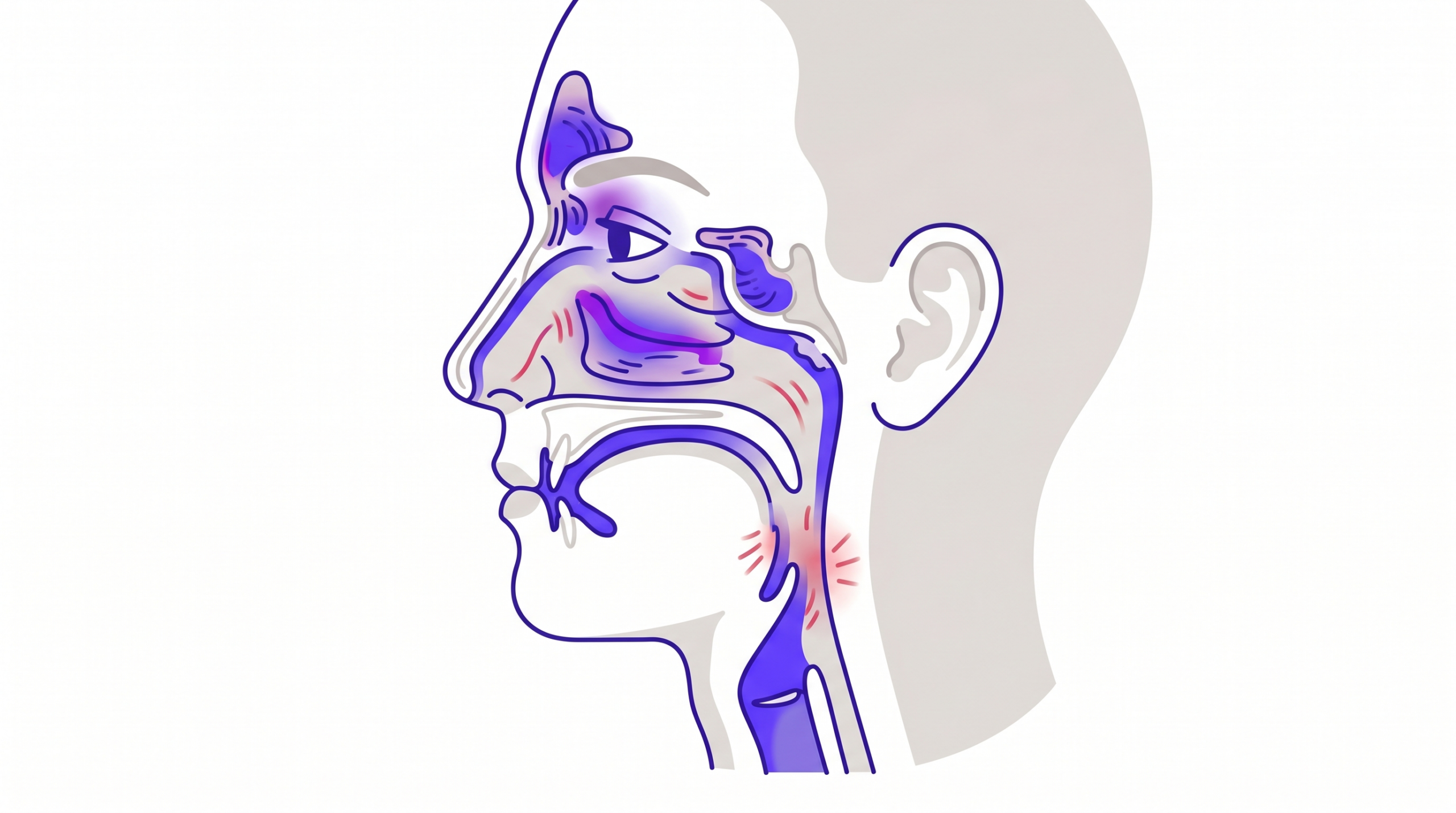 Sinusitis Síntomas Sin Mocos: Causas y Cuándo Buscar Atención