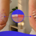 psoriasis vs eczema — CityHealth